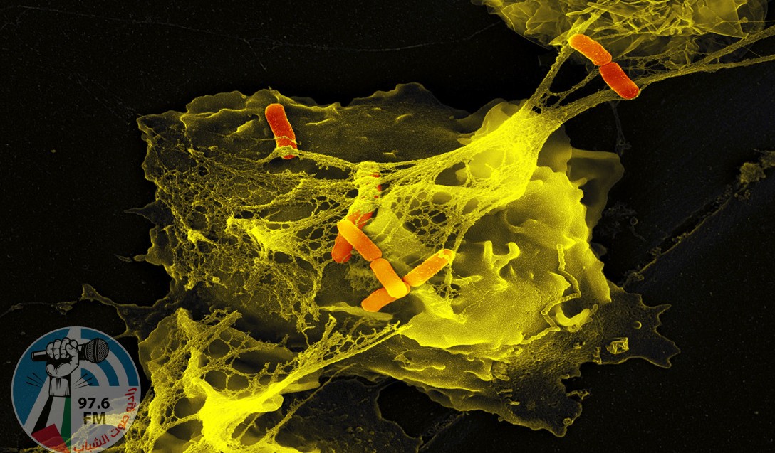 Stimulated neutrophil with NETs and some trapped Shigella bacteria