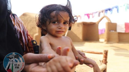 الجوع والمياه الملوثة يهددان حياة اليمنيين في محافظة حجة