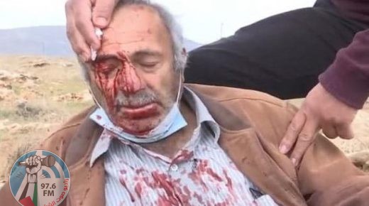 إصابة مسن ونجله بجروح إثر اعتداء المستوطنين على مزارعين في خربة الطويل شرق نابلس