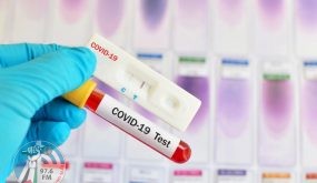 فيروس كورونا: فحوص كشف كوفيد-19 “قد تلتقط فيروسات ميتة”
