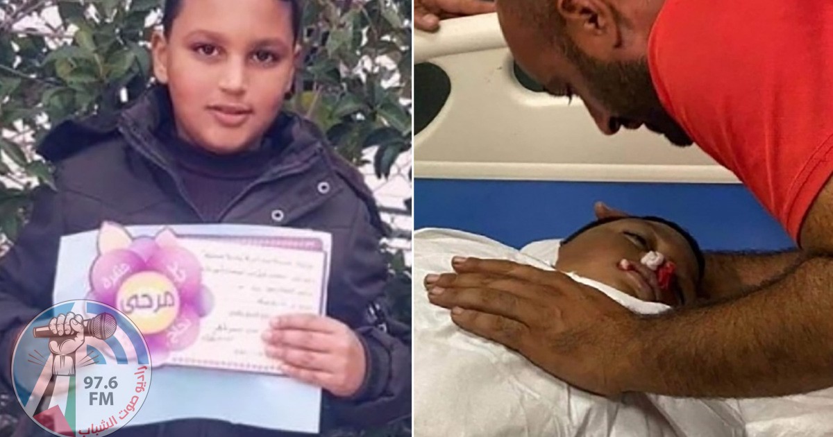 استشهاد الطفل محمد العلامي متأثرا بإصابته برصاص الاحتلال في الخليل