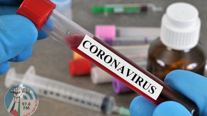 مي كيلة : 9 وفيات و270 إصابة جديدة بفيروس “كورونا” و1270 حالة تعافٍ