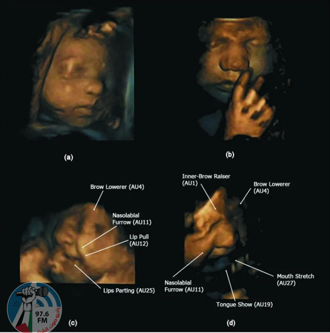 موجات فوق صوتية تظهر شيئا غريبا يحدث للأجنة داخل الرحم