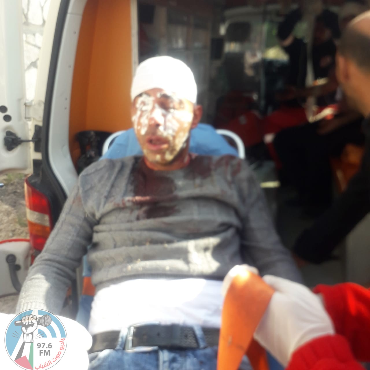 إصابة 3 مواطنين وتحيطم 4 مركبات إثر هجوم للمستوطنين قرب برقة شمال نابلس