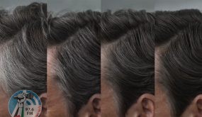 “مضاد للشيخوخة” يمكن أن يعالج السبب الجذري لشيب الشعر