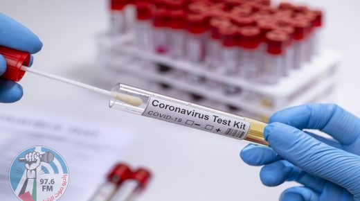 Hands with protective glove, examining a novel coronavirus covid 19 test tube the result is + positive.