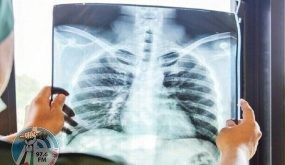 صور “صادمة” بالأشعة السينية تكشف عن آثار تلف الرئة في مرضى “كوفيد-19” غير الملقحين
