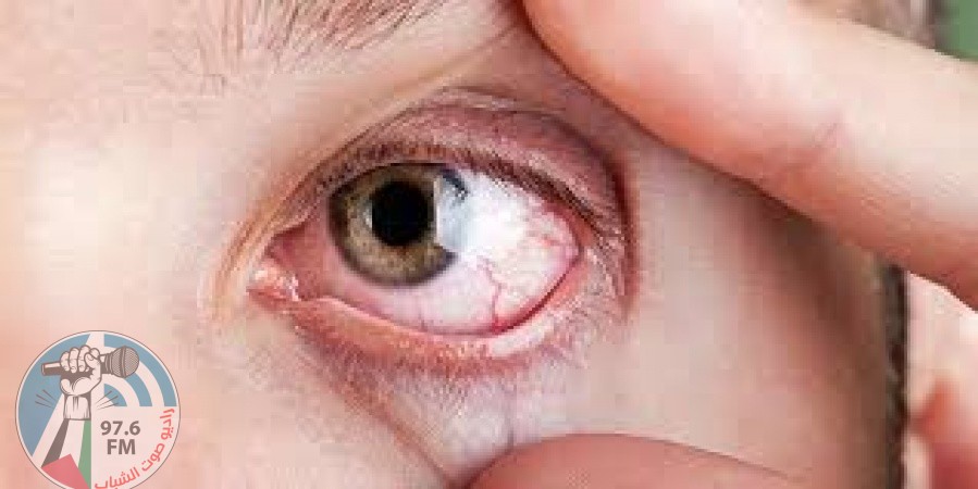 طبيب روسي : حالة العين تكشف أوضاع أعضاء الجسم الأخرى