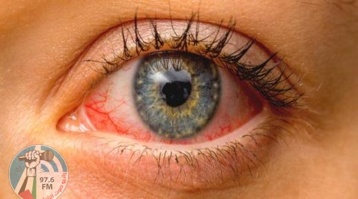 ماهي الأمراض التي تكشفها عينك؟