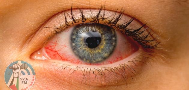 ماهي الأمراض التي تكشفها عينك؟