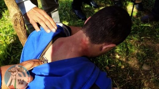 إصابة شاب بجروح بعد اعتداء مستوطنين عليه غرب نابلس