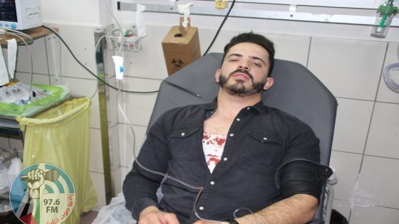 إصابة طبيب بجروح ورضوض جراء اعتداء جنود الاحتلال عليه شرق طولكرم