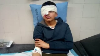 استئصال عين طفل بعد إصابته برصاص الاحتلال شمال غرب نابلس