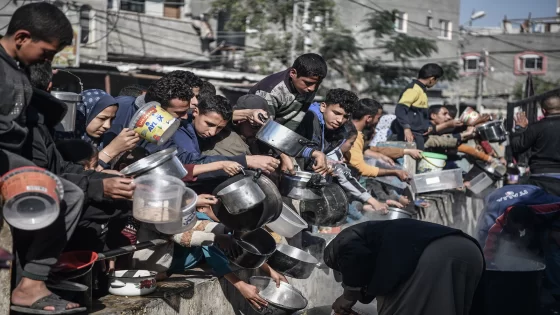 "الأغذية العالمي": ارتفاع سوء التغذية في قطاع غزة إلى مستويات طارئة