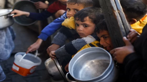 الأونروا: واحد من كل 3 أطفال دون العامين في غزة يعاني من سوء تغذية حاد
