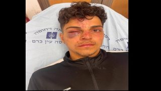 مستوطنون يعتدون على شاب مقدسي
