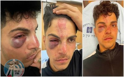 مستوطنون يعتدون بالضرب على فتى في البلدة القديمة من القدس