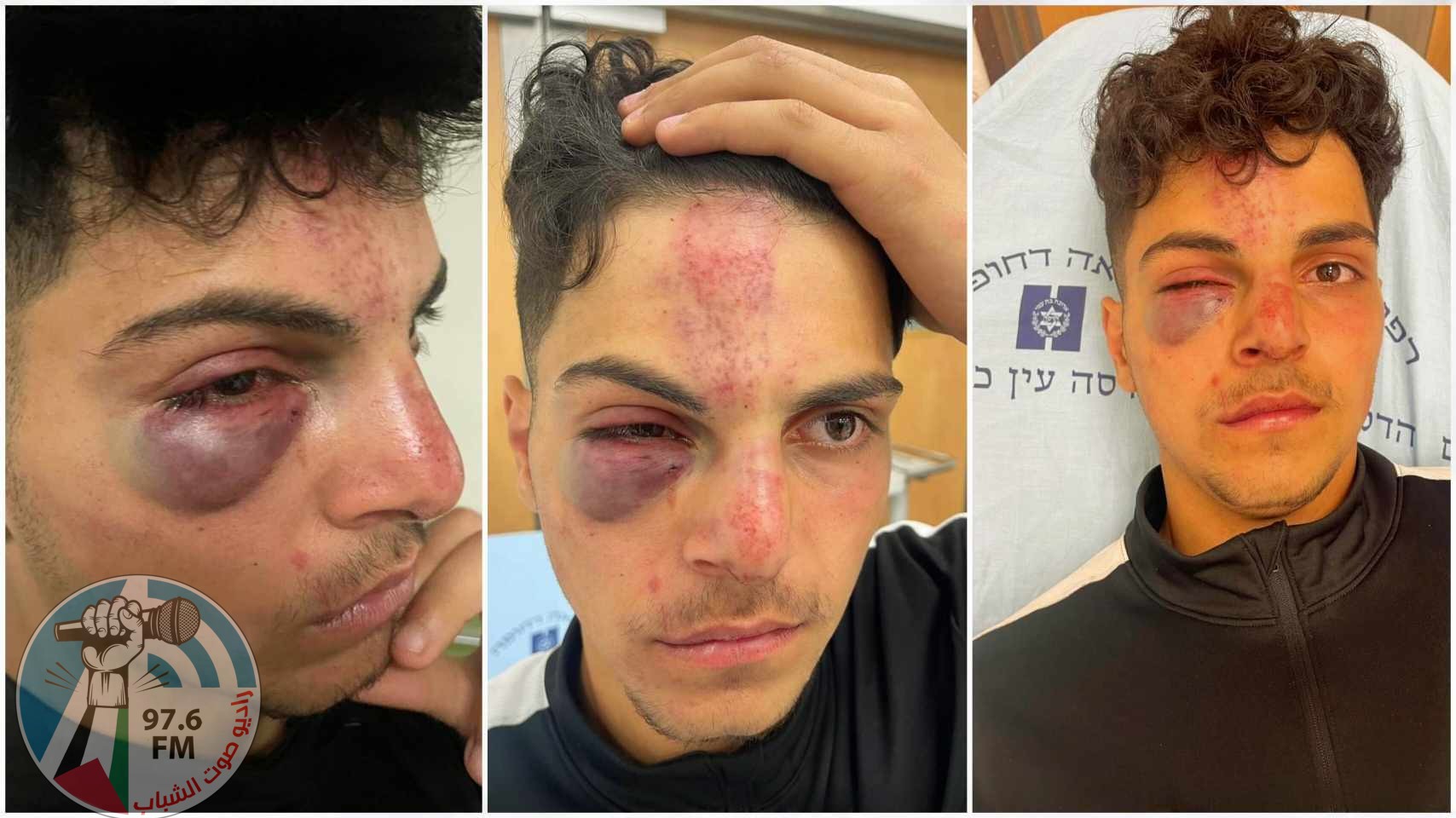 مستوطنون يعتدون بالضرب على فتى في البلدة القديمة من القدس