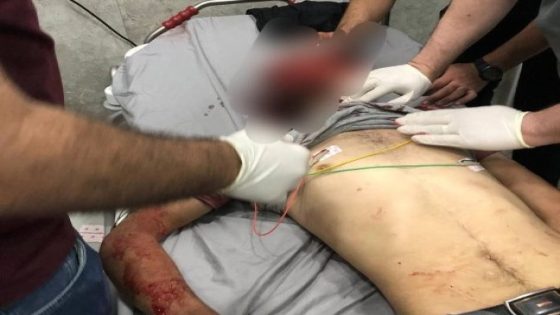 ثلاثة شهداء ..بعد 13 ساعة جيش الاحتلال يعلن انتهاء اقتحام جنين