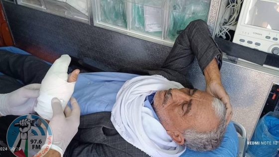 مستعمرون يعتدون بالضرب على مسن وشاب في مسافر يطا جنوب الخليل