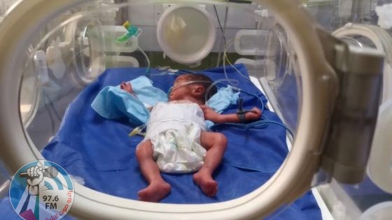 مستشفى العودة: إنقاذ جنين من رحم والدته الشهيدة