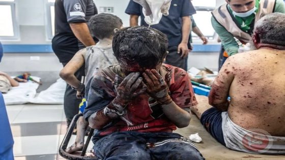 رغم توفر الأماكن لرعايتهم- السويد ترفض استقبال جرحى غزة