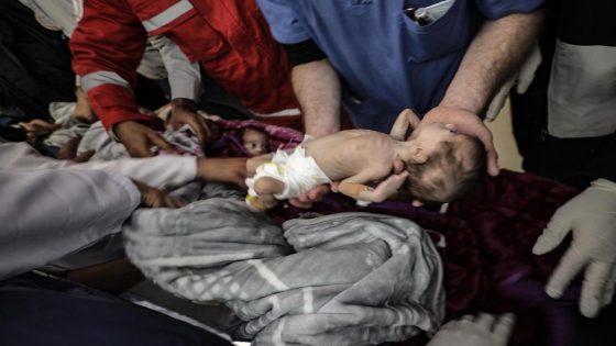 “اليونيسف” تدعو إلى هدنة 7 أيام في غزة لتلقيح 640 ألف طفل ضد شلل الأطفال