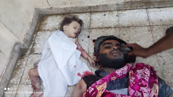 شهداء في غزة والنصيرات وقصف مدفعي على حيّ الزيتون