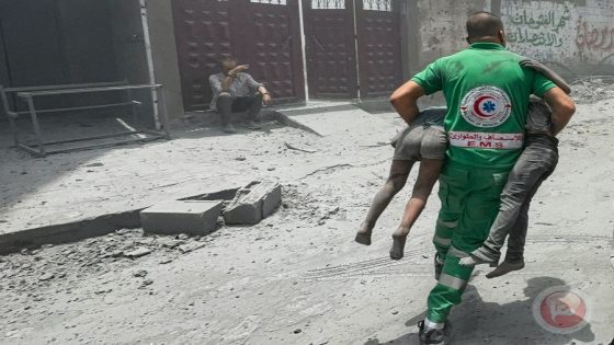 31 شهيدا خلال 24 ساعة في غزة