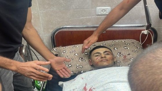 شهيد وجريح في قصف جوي على السيلة الحارثية في جنين