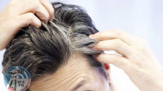 دراسة سعودية تكشف سبب الشيب قبل سن الثلاثين