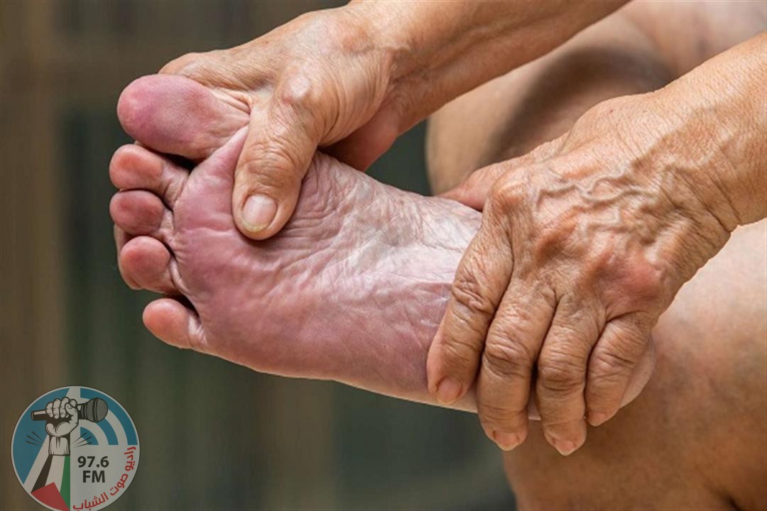 علامات تحذيرية على قدميك قد تكشف مشاكل صحية غير مرئية
