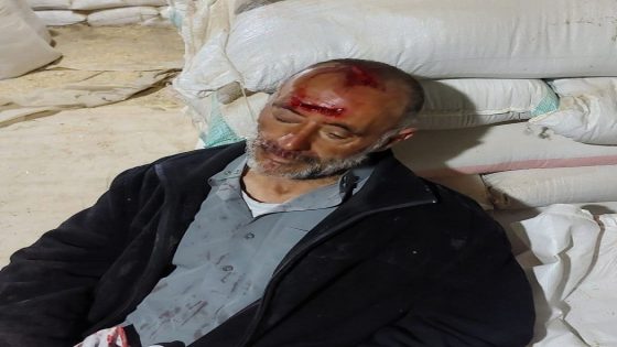إصابة مسن بعد اعتداء مستوطنين عليه جنوب الخليل