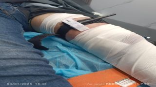 إصابة فتى برصاص الاحتلال في بلدة بيت أمر