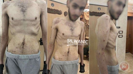 مركز حقوقي: السجون الإسرائيلية قبور للأحياء