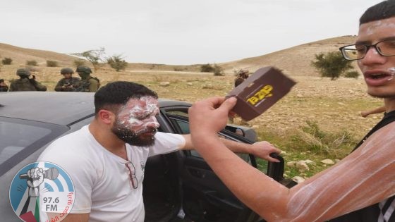 إصابة 4 مواطنين باعتداء الاحتلال شمال أريحا