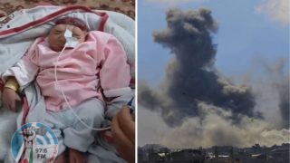ولادة طفلة "بلا دماغ" مع تزايد ظاهرة "تشوه الأجنة" في قطاع غزة