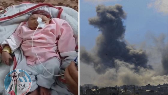 ولادة طفلة "بلا دماغ" مع تزايد ظاهرة "تشوه الأجنة" في قطاع غزة