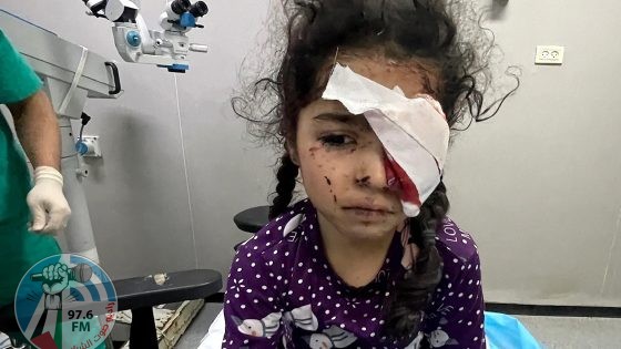 غزة: 1500 مواطن فقدوا البصر جراء حرب الإبادة و4000 مهددون بفقدانه