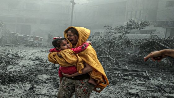 الدفاع المني بغزة: من لا يموت بالقصف يموت بالجوع