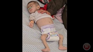 استشهاد طفلة في غزة بسبب المجاعة ما يرفع الحصيلة إلى 54