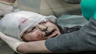 1500 مواطنا بغزة فقدوا البصر بسبب الحرب