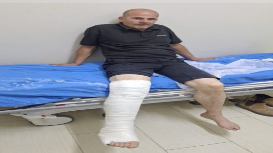 إصابة مواطن بكسر في الساق جراء اعتداء قوات الاحتلال عليه في ديربلوط
