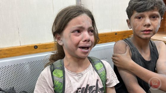 79 شهيدا خلال يوم في قطاع غزة