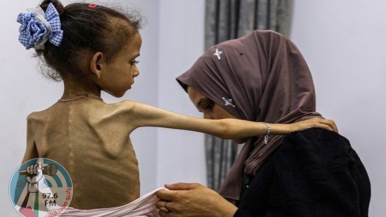 وكالات أممية تحذّر: مؤشرات الغذاء في قطاع غزة تتجاوز عتبات المجاعة