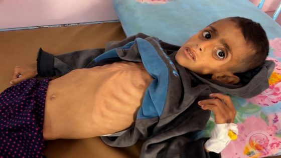 المجاعة في غزة تتسبب بتراجع الدعم في امريكا لاسرائيل