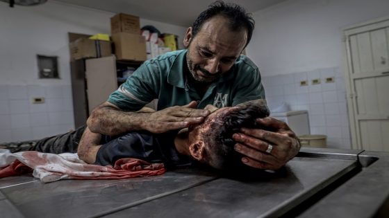 105 شهداء و356 إصابة خلال يوم في قطاع غزة