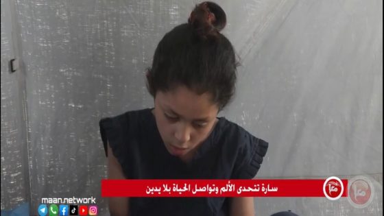 غزة.. الطفلة سارة تتحدى الألم وتواصل الحياة بلا يدين