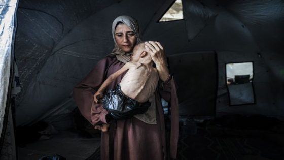 وفاة رضيع نتيجة سوء التغذية في غزة