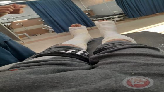 إصابة عامل من بيت أمر بكسر في القدمين بعد اعتداء جنود الاحتلال عليه بالضرب